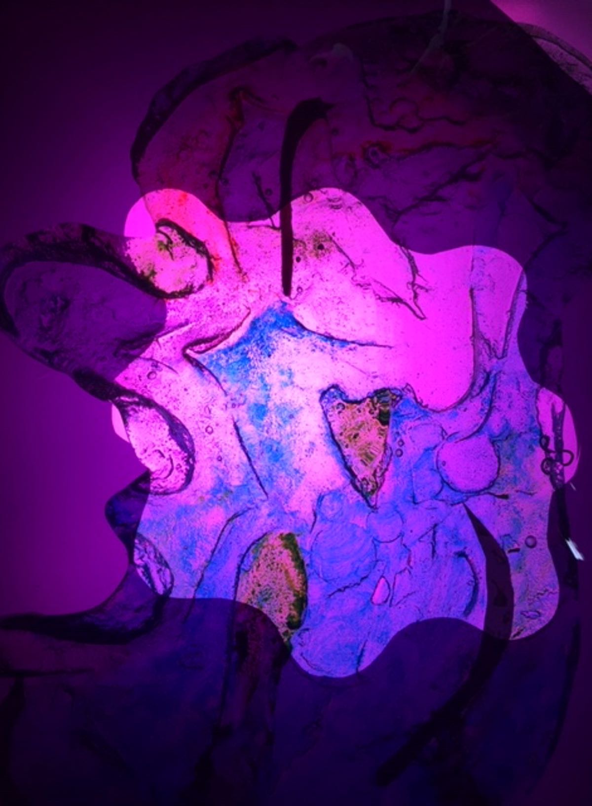 Amoeba 3